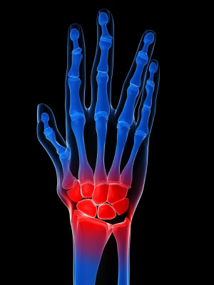 What is the best relief for joint pain?